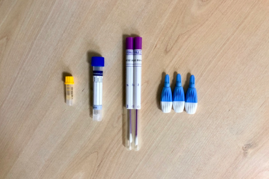 Sample tubes used in home testing kit for sexually transmitted infections (STIs)