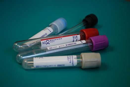 Sample tubes on a green background